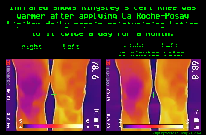 A moisturing lotion warmed my knee.